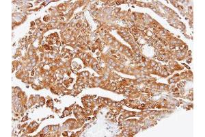 Immunohistochemistry (IHC) image for anti-Actin Related Protein 2/3 Complex, Subunit 2, 34kDa (ARPC2) antibody (ABIN2855249)