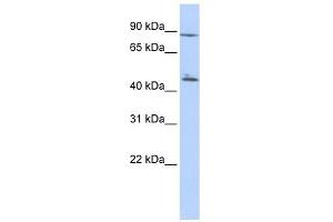 C6ORF199 antibody used at 1 ug/ml to detect target protein. (AKD1 抗体  (N-Term))