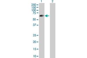 Western Blot analysis of LRIT3 expression in transfected 293T cell line by LRIT3 MaxPab polyclonal antibody. (LRIT3 抗体  (AA 1-552))