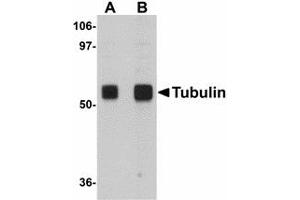 Image no. 1 for anti-alpha Tubulin (TUBA1) (N-Term) antibody (ABIN478060) (alpha Tubulin 抗体  (N-Term))