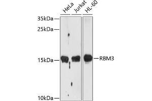 Western blot analysis of extracts of various cell lines, using RBM3 antibody  at 1:1000 dilution. (RBM3 抗体  (AA 1-157))