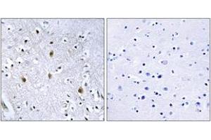 Immunohistochemistry analysis of paraffin-embedded human brain tissue, using IRS-1 (Ab-639) Antibody. (IRS1 抗体  (AA 605-654))