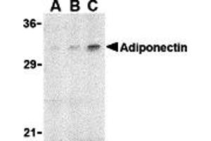 Western blot analysis of adiponectin in rat brain cell lysate with adiponectin antibody at (A) 1, (B) 2, and (C) 4 µg/mL. (ADIPOQ 抗体  (N-Term))