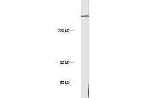 dilution: 1 : 1000, sample: rat brain homogenate (Golgin B1 (GOLGB1) 抗体)