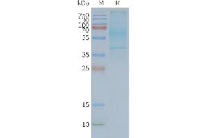 Human -Nanodisc, Flag Tag on SDS-PAGE (GPR20 蛋白)