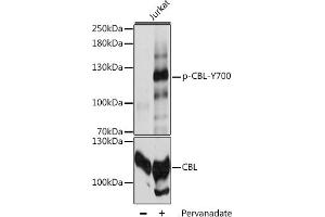 Western blot analysis of extracts of Jurkat cells, using Phospho-CBL-Y700 antibody (ABIN6135196, ABIN6136034, ABIN6136035 and ABIN6225680) at 1:2000 dilution or CBL antibody (ABIN6131302, ABIN6138002, ABIN6138004 and ABIN6213970). (CBL 抗体  (pTyr700))