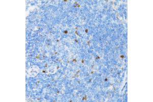 Immunohistochemistry of paraffin-embedded rat spleen using SIAH1 antibody (ABIN5971329) at dilution of 1/100 (40x lens). (SIAH1 抗体)