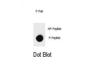 Dot blot analysis of Phospho-IKKB- Antibody Phospho-specific Pab (ABIN1539772 and ABIN2839876) on nitrocellulose membrane. (IKBKB 抗体  (pSer697))