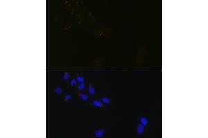 Immunofluorescence analysis of U-2 OS cells using GR Rabbit mAb (ABIN1679751, ABIN3015980, ABIN3015981 and ABIN7101472) at dilution of 1:100 (40x lens). (GORASP1 抗体)