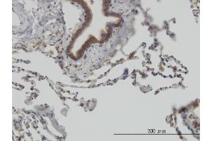 Immunostaining (ISt) image for anti-Stress-Induced-phosphoprotein 1 (STIP1) (AA 445-543) antibody (ABIN564757)