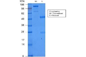 SDS-PAGE (SDS) image for anti-CD86 (CD86) antibody (ABIN6941145)