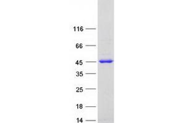 Aminomethyltransferase Protein (AMT) (Myc-DYKDDDDK Tag)