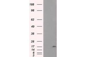 HEK293T cells were transfected with the pCMV6-ENTRY control (Left lane) or pCMV6-ENTRY NME4 (Right lane) cDNA for 48 hrs and lysed. (NME4 抗体)