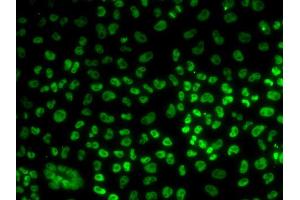 Immunofluorescence analysis of U20S cell using BUB3 antibody. (BUB3 抗体)