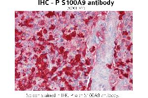 Image no. 1 for anti-S100 Calcium Binding Protein A9 (S100A9) (C-Term) antibody (ABIN1515088) (S100A9 抗体  (C-Term))
