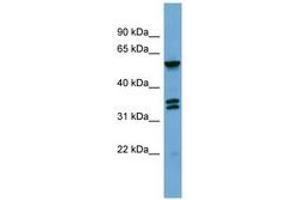 Image no. 1 for anti-G Protein-Coupled Receptor Kinase 4 (GRK4) (AA 359-408) antibody (ABIN6745674) (GRK4 抗体  (AA 359-408))