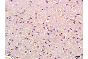 Formalin-fixed and paraffin embedded rat brain labeled with Anti-P105 RB Polyclonal Antibody, Unconjugated (ABIN680548) at 1:200 followed by conjugation to the secondary antibody and DAB staining (Retinoblastoma 1 抗体  (AA 51-150))