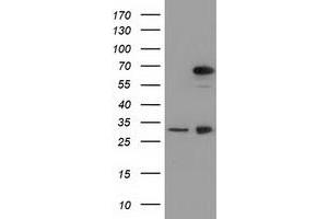 HEK293T cells were transfected with the pCMV6-ENTRY control (Left lane) or pCMV6-ENTRY MPP3 (Right lane) cDNA for 48 hrs and lysed. (MPP3 抗体)