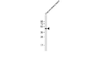 Anti-HIS Tag Antibody at 1:2000 dilution + 12tag recombinant protein lysate Lysates/proteins at 20 μg per lane. (His 标记 抗体)