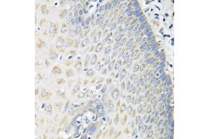 Immunohistochemistry of paraffin-embedded human esophagus using OXCT1 antibody (ABIN5974499) at dilution of 1/100 (40x lens). (OXCT1 抗体)