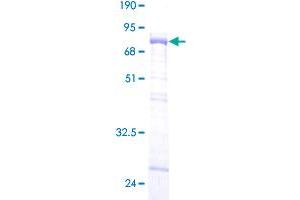 Image no. 1 for Muscleblind-like Protein 1 (MBNL1) (AA 1-382) protein (GST tag) (ABIN1310482) (MBNL1 Protein (AA 1-382) (GST tag))