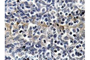 Immunohistochemistry analyzes of VASP antibody in paraffin-embedded human tonsil tissue. (VASP 抗体)