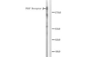 Western blot analysis of extracts from NIH/3T3 cells. (PDGFRB 抗体)