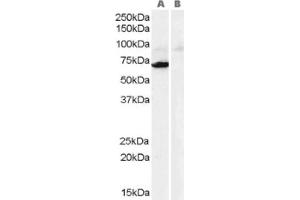 Image no. 1 for anti-Monoamine Oxidase A (MAOA) (Internal Region) antibody (ABIN374605) (Monoamine Oxidase A 抗体  (Internal Region))