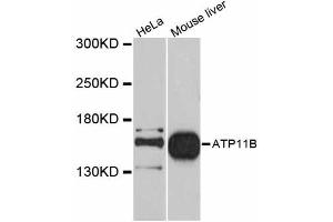 Western blot analysis of extracts of various cell lines, using ATP11B antibody (ABIN5997278) at 1/1000 dilution. (ATP11B 抗体)