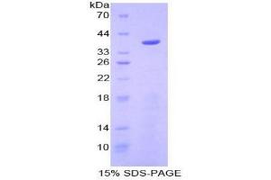 SDS-PAGE analysis of Mouse Apolipoprotein C1 Protein. (APOC1 蛋白)