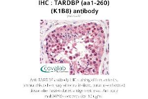 Image no. 2 for anti-TAR DNA Binding Protein (TARDBP) (AA 1-260) antibody (ABIN1723216) (TARDBP 抗体  (AA 1-260))