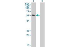 Western Blot analysis of ABLIM3 expression in transfected 293T cell line by ABLIM3 MaxPab polyclonal antibody. (ABLIM3 抗体  (AA 1-544))