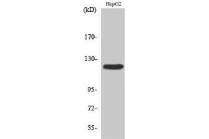 Western Blotting (WB) image for anti-PTK2 Protein tyrosine Kinase 2 (PTK2) (Thr433) antibody (ABIN3184579) (FAK 抗体  (Thr433))