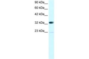 Western Blotting (WB) image for anti-Chromobox Homolog 4 (CBX4) antibody (ABIN2460142) (CBX4 抗体)