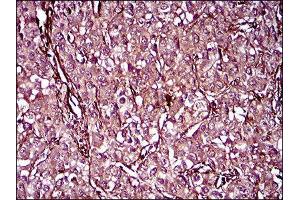 Immunohistochemistry (IHC) image for anti-Melanoma Cell Adhesion Molecule (MCAM) (AA 84-189) antibody (ABIN1845785) (MCAM 抗体  (AA 84-189))