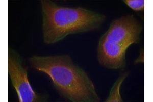 Immunofluorescence staining of methanol-fixed Hela cells using PKCth(Phospho-Ser676) Antibody. (PKC theta 抗体  (pSer676))