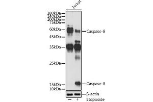 Western Blotting (WB) image for anti-Caspase 8 (CASP8) (AA 1-479) antibody (ABIN6137970)