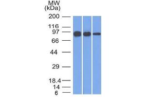 Western Blot of A431, A549 and MCF-7 cell lysates using Catenin, beta Mouse Monoclonal Antibody (12F7) (CTNNB1 抗体  (N-Term))