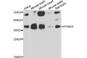 Western blot analysis of extracts of various cell lines, using EPM2A antibody. (EPM2A 抗体)