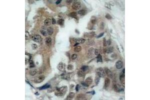 Image no. 2 for anti-BCL2-Associated Agonist of Cell Death (BAD) (pSer136), (pSer99) antibody (ABIN317969) (BAD 抗体  (pSer99, pSer136))