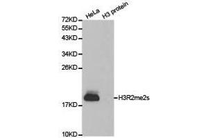 Western Blotting (WB) image for anti-Histone 3 (H3) (H3R2me2s) antibody (ABIN1873009) (Histone 3 抗体  (H3R2me2s))