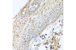 Immunohistochemistry of paraffin-embedded human esophagus using NDUFA2 antibody (ABIN5974497) at dilution of 1/100 (40x lens). (NDUFA2 抗体)
