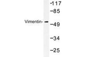 Western blot analysis of Vimentin antibody in extracts from 293 cells. (Vimentin 抗体)