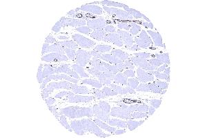 Skeletal muscle In skeletal muscle endothelial vWF immunostaining is strong in postcapillary venules and somewhat weaker in capillaries (Recombinant VWF 抗体  (AA 1815-1939))