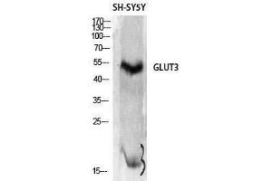 Western Blotting (WB) image for anti-Solute Carrier Family 2 (Facilitated Glucose Transporter), Member 3 (SLC2A3) (C-Term) antibody (ABIN3175292) (SLC2A3 抗体  (C-Term))