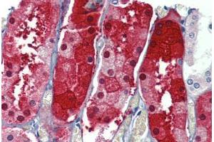 Human Kidney: Formalin-Fixed, Paraffin-Embedded (FFPE) (Junctophilin 4 抗体  (Internal Region))