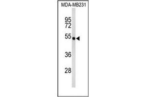 Western blot analysis of FAD synthetase Antibody (C-term) in MDA-MB231 cell line lysates (35ug/lane). (FAD Synthetase 抗体  (C-Term))