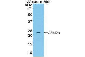 Western Blotting (WB) image for anti-Non Metastatic Cells 6, Protein Expressed In (AA 1-184) antibody (ABIN1860010) (Non Metastatic Cells 6, Protein Expressed In (AA 1-184) 抗体)