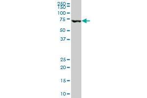 MBD1 monoclonal antibody (M05), clone 2B10. (MBD1 抗体  (AA 415-508))