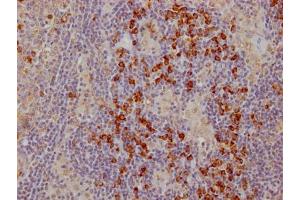 IHC image of ABIN7127437 diluted at 1:100 and staining in paraffin-embedded human lymph node tissue performed on a Leica BondTM system. (Recombinant CTLA4 抗体)